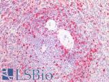 STMN1 / Stathmin / LAG Antibody - Human Spleen: Formalin-Fixed, Paraffin-Embedded (FFPE)