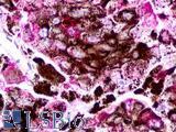 TAAR2 / GPR58 Antibody - Skin, Malignant Melanoma