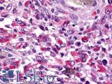 TAAR8 Antibody - Brain, Glioblastoma