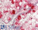TFF1 / pS2 Antibody - Human Small Intestine: Formalin-Fixed, Paraffin-Embedded (FFPE)