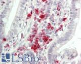 TGFBR2 Antibody - Human Small Intestine: Formalin-Fixed, Paraffin-Embedded (FFPE)