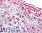 TLR4 Antibody - Anti-TLR4 antibody IHC of human placenta, decidua. Immunohistochemistry of formalin-fixed, paraffin-embedded tissue after heat-induced antigen retrieval.