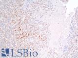 TP53 / p53 Antibody - Human Tonsil: Formalin-Fixed, Paraffin-Embedded (FFPE)