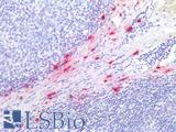 TPSAB1 / Mast Cell Tryptase Antibody - Human Tonsil, Mast Cells: Formalin-Fixed, Paraffin-Embedded (FFPE)