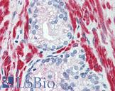 TRPM8 Antibody - Anti-TRPM8 antibody IHC of human prostate. Immunohistochemistry of formalin-fixed, paraffin-embedded tissue after heat-induced antigen retrieval.