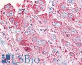 USP20 / VDU2 Antibody - Lung, Non Small-Cell Carcinoma