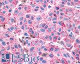 VIPR1 Antibody - Skin, Malignant Melanoma