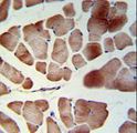 PATL1 Antibody - PATL1 Antibody IHC of formalin-fixed and paraffin-embedded skeletal muscle followed by peroxidase-conjugated secondary antibody and DAB staining.