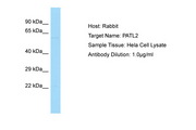 PATL2 Antibody -  This image was taken for the unconjugated form of this product. Other forms have not been tested.