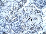 PAX2 Antibody - PAX2 antibody P100859_T100-NP_003979-PAX2 (paired box gene 2) Antibody was used in IHC to stain formalin-fixed, paraffin-embedded human kidney.  This image was taken for the unconjugated form of this product. Other forms have not been tested.