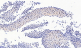 PAX3 Antibody - PAX3 antibody (4.5µg/ml) staining of paraffin embedded Human Esophagus. Heat induced antigen retrieval with citrate buffer pH 6, HRP-staining.