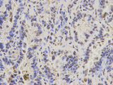 PAX3 Antibody - Immunohistochemistry of paraffin-embedded rat lung using PAX3 antibody at dilution of 1:200 (400x lens).