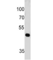 PAX7 Antibody - Western blot testing of human HeLa cell lysate with PAX7 antibody (clone PAX7/497). Expected molecular weight: 55-57 kDa.