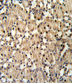 PAX8 Antibody - Formalin-fixed and paraffin-embedded mouse kidney reacted with PAX8 Antibody , which was peroxidase-conjugated to the secondary antibody, followed by DAB staining. This data demonstrates the use of this antibody for immunohistochemistry; clinical relevance has not been evaluated.