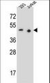 PAX9 Antibody - PAX9 Antibody western blot of 293,Jurkat cell line lysates (35 ug/lane). The PAX9 antibody detected the PAX9 protein (arrow).