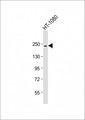 PBRM1 / BAF180 / PB1 Antibody - Anti-PBRM1 Antibody at 1:1000 dilution + HT-1080 whole cell lysate Lysates/proteins at 20 ug per lane. Secondary Goat Anti-mouse IgG, (H+L), Peroxidase conjugated at 1:10000 dilution. Predicted band size: 193 kDa. Blocking/Dilution buffer: 5% NFDM/TBST.