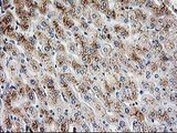 PBX1 Antibody - IHC of paraffin-embedded Human liver tissue using anti-PBX1 mouse monoclonal antibody.