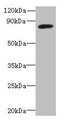 PBXIP1 / HPIP Antibody - Western blot All lanes: PBXIP1 antibody at 4µg/ml + A549 whole cell lysate Secondary Goat polyclonal to rabbit IgG at 1/10000 dilution Predicted band size: 81, 78, 73 kDa Observed band size: 81 kDa