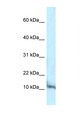 PCBD1 / PHS Antibody - PCBD1 / PCD antibody Western blot of Mouse Brain lysate. Antibody concentration 1 ug/ml.  This image was taken for the unconjugated form of this product. Other forms have not been tested.