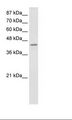 PCBP4 Antibody - Jurkat Cell Lysate.  This image was taken for the unconjugated form of this product. Other forms have not been tested.