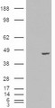 PCBP4 Antibody - HEK293 overexpressing PCBP4 (RC200749) and probed with (mock transfection in first lane).