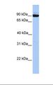 PCDH17 Antibody - HepG2 cell lysate. Antibody concentration: 1.0 ug/ml. Gel concentration: 12%.  This image was taken for the unconjugated form of this product. Other forms have not been tested.