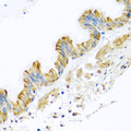 PCDHA12 Antibody - Immunohistochemistry of paraffin-embedded human trachea tissue.