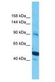 PCDHGB5 Antibody - PCDHGB5 antibody Western Blot of Thymus Tumor. Antibody dilution: 1 ug/ml.  This image was taken for the unconjugated form of this product. Other forms have not been tested.