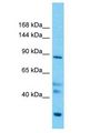 PCDHGB5 Antibody - PCDHGB5 antibody Western Blot of Thymus Tumor. Antibody dilution: 1 ug/ml.  This image was taken for the unconjugated form of this product. Other forms have not been tested.