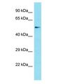 PCED1B Antibody - PCED1B antibody Western Blot of Jurkat. Antibody dilution: 1 ug/ml.  This image was taken for the unconjugated form of this product. Other forms have not been tested.