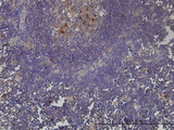 PCNA-Associated Factor Antibody - Immunoperoxidase of monoclonal antibody to KIAA0101 on formalin-fixed paraffin-embedded human lymph node tissue. [antibody concentration 3 ug/ml].