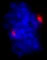 PCNT / Pericentrin Antibody - Detection of Human Pericentrin/Kendrin by Immunocytochemistry. Sample: NBF-fixed asynchronous HeLa cells. Antibody: Affinity purified rabbit anti-Pericentrin/Kendrin used at a dilution of 1:500. Detection: Red-fluorescent Alexa Fluor 594 goat anti-rabbit IgG (Invitrogen).