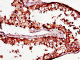 PCOTH Antibody - Immunohistochemistry of paraffin-embedded human testis tissue using C1QTNF9B-AS1 Antibody at dilution of 1:100
