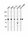 PCSK1 Antibody - All lanes: Anti-PCSK1 Antibody (C-Term) at 1:2000 dilution Lane 1: Hela whole cell lysate Lane 2: A549 whole cell lysate Lane 3: PC-12 whole cell lysate Lane 4: mouse brain lysate Lane 5: NCI-H460 whole cell lysate Lysates/proteins at 20 µg per lane. Secondary Goat Anti-Rabbit IgG, (H+L), Peroxidase conjugated at 1/10000 dilution. Predicted band size: 84 kDa Blocking/Dilution buffer: 5% NFDM/TBST.
