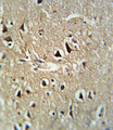 PCSK2 Antibody - Formalin-fixed and paraffin-embedded human brain tissue reacted with PCSK2 Antibody , which was peroxidase-conjugated to the secondary antibody, followed by DAB staining. This data demonstrates the use of this antibody for immunohistochemistry; clinical relevance has not been evaluated.