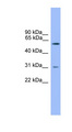 PCSK2 Antibody - PCSK2 antibody Western blot of HeLa lysate.  This image was taken for the unconjugated form of this product. Other forms have not been tested.