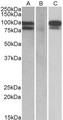 PCSK9 Antibody - HEK293 lysate (10ug protein in RIPA buffer) overexpressing Human PCSK9 with C-terminal MYC tag probed with (0.5ug/ml) in Lane A and probed with anti-MYC Tag (1/1000) in lane C. Mock-transfected HEK293 probed (1mg/ml) in Lane B. Primar