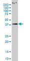 PCYT1A / CCT Alpha Antibody - PCYT1A monoclonal antibody (M02), clone 6E6. Western blot of PCYT1A expression in K-562.