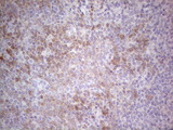 PD-L2 / PDCD1LG2 / CD273 Antibody - IHC of paraffin-embedded Human tonsil using anti-PDCD1LG2 mouse monoclonal antibody. (Heat-induced epitope retrieval by 1 mM EDTA in 10mM Tris, pH8.5, 120°C for 3min).