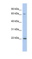 PDAP1 Antibody - PDAP1 antibody Western blot of HeLa lysate. This image was taken for the unconjugated form of this product. Other forms have not been tested.