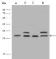 PDCD10 Antibody - Anti-PDCD10 rabbit polyclonal antibody at 1:500 dilution. Lane A: HepG2 Whole Cell Lysate. Lane B: Hela Whole Cell Lysate. Lane C: K562 Whole Cell Lysate. Lane D: Jurkat Whole Cell Lysate. Lysates/proteins at 30 ug per lane. Secondary: Goat Anti-Rabbit IgG (H+L)/HRP at 1/10000 dilution. Developed using the ECL technique. Performed under reducing conditions. Predicted band size: 25 kDa. Observed band size: 27 kDa.