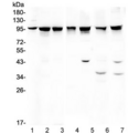 PDCD6IP / ALIX Antibody - Western blot testing of 1) rat testis, 2) mouse testis, 3) human A375 and 4) human HeLa lysate wtih ALIX antibody. Expected/observed molecular weight ~96 kDa.