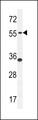 PDE12 Antibody - PDE12 Antibody western blot of MDA-MB231 cell line lysates (35 ug/lane). The PDE12 antibody detected the PDE12 protein (arrow).
