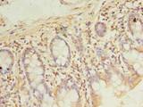 PDE6D / PDE6 Delta Antibody - Immunohistochemistry of paraffin-embedded human small intestine tissue using antibody at dilution of 1:100.