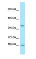 PDE6G / PDE6 Gamma Antibody - PDE6G / PDE6 Gamma antibody Western Blot of Jurkat.  This image was taken for the unconjugated form of this product. Other forms have not been tested.