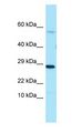 PDE7A Antibody - PDE7A antibody Western Blot of Placenta.  This image was taken for the unconjugated form of this product. Other forms have not been tested.
