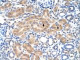 PDE9A Antibody - PDE9A antibody PDE9A(phosphodiesterase 9A) Antibody was used in IHC to stain formalin-fixed, paraffin-embedded human kidney.  This image was taken for the unconjugated form of this product. Other forms have not been tested.