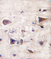PDGF-AA Antibody - Formalin-fixed and paraffin-embedded human brain tissue reacted with PDGFA antibody , which was peroxidase-conjugated to the secondary antibody, followed by DAB staining. This data demonstrates the use of this antibody for immunohistochemistry; clinical relevance has not been evaluated.