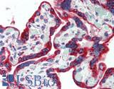 PDGF-AA Antibody - Human Placenta: Formalin-Fixed, Paraffin-Embedded (FFPE)