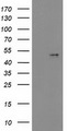 PDGF-D Antibody - HEK293T cells were transfected with the pCMV6-ENTRY control (Left lane) or pCMV6-ENTRY PDGFD (Right lane) cDNA for 48 hrs and lysed. Equivalent amounts of cell lysates (5 ug per lane) were separated by SDS-PAGE and immunoblotted with anti-PDGFD.